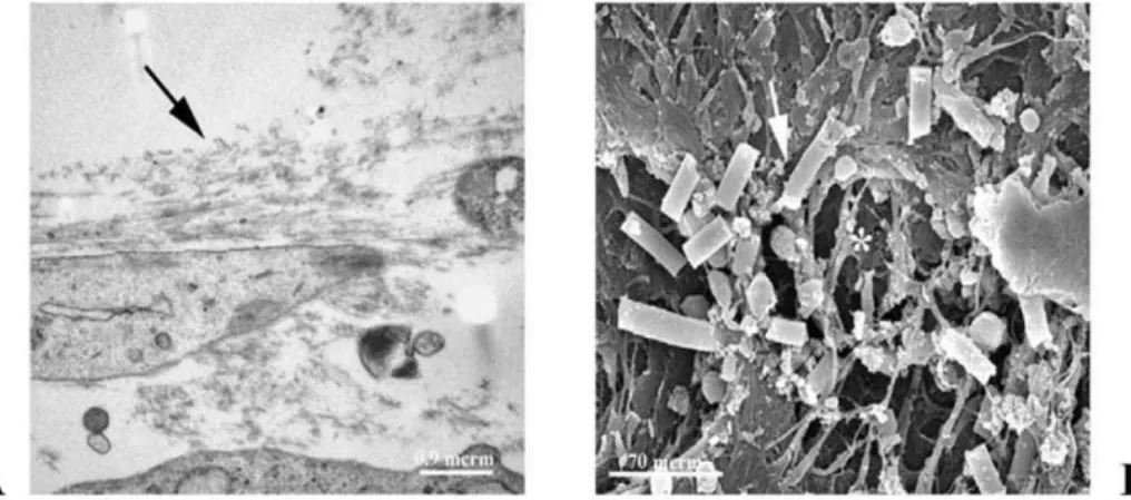 Fig. 2. Transmission and scanning electron microscopy. (A) TEM of sections of MSC polymer constructs shows cell elements typical of viable, secretionally active myofibroblasts with deposition of collagen fibrils (arrow)