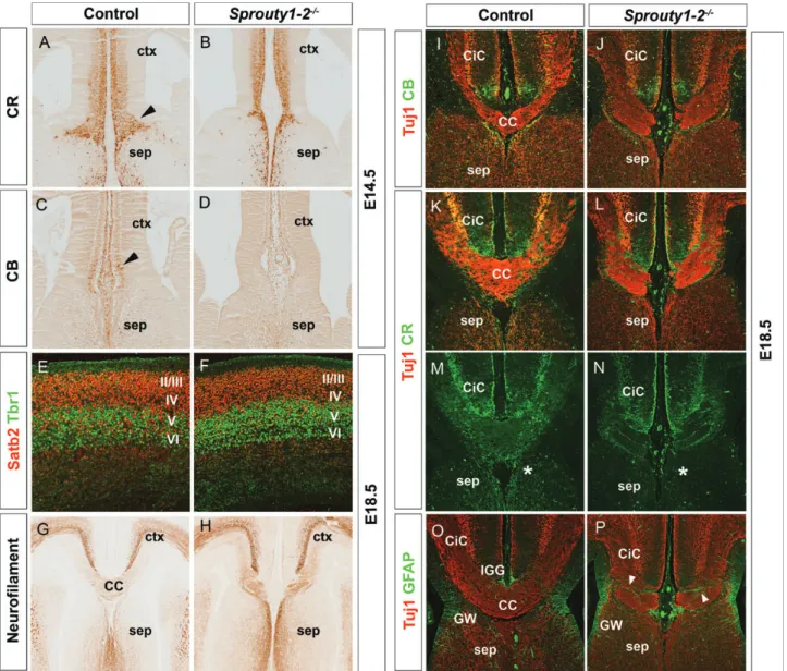 Figure 4. Sprouty1 – 2 double mutants lack the CC. (A and B) In E14.5 control embryos, CR + guidepost neurons form a well organized band of neurons at the CSB, which is largely missing in Sprouty1/2 double mutants