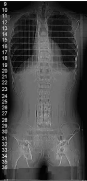 Figure 1. Topogram of the Alderson phantom (without head) with slice numbers.