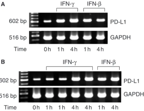 Fig. 1. RT-PCR analysis of PD-L1 mRNA expression in renal TEC treated with IFNs. Murine macrophage RAW264.7 cells (positive control cell line) (A) and primary renal TEC cultures generated from B6 mice (B) were treated with IFN-b (200 U/ml) or IFN-g (100 U/