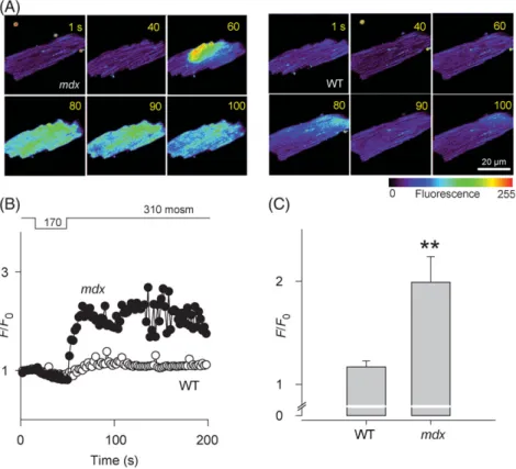Figure 1B shows the averaged changes in intracellular ﬂuor- ﬂuor-escence in all studied WT and mdx cardiomyocytes,  normal-ized to the resting values before osmotic shock