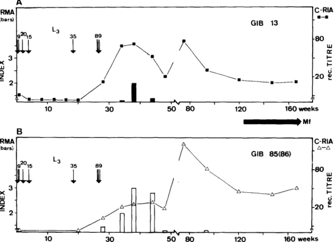 Fig.  2.  Detection  of circulating  antigen by  IRMA  expressed as antigen index (vertical  bars) and serum antibodies (curves) competing with  the  binding  of  a monoclonal  antibody  to  0