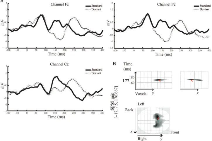 Figure 1. ( A ) Grand average ERP responses in the placebo condition to the sixth tone of stimulus trains ( “ standard tone ” ; black line) and the ﬁ rst tone of stimulus trains ( “ deviant ” tone; dashed line) across frontal and central electrodes