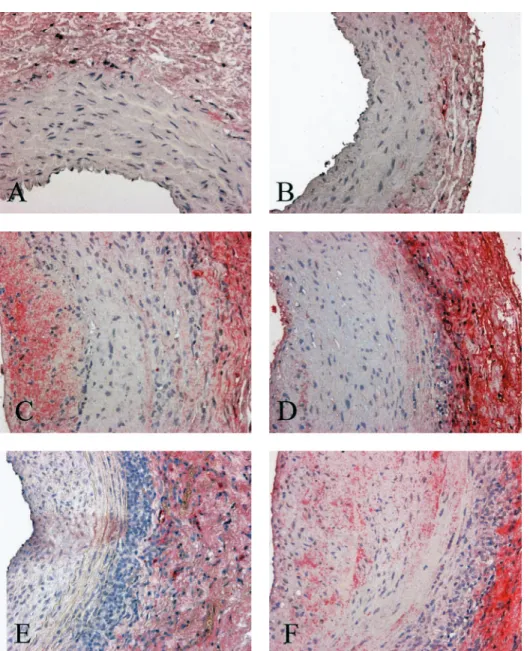 Fig. 5. TGF-b immunostaining in the different groups of SHR rats: sham-operated (A) and iso-transplanted (B) SHR animals as negative controls compared with untreated allotransplanted SHR (C), allotransplanted SHR treated with the ACE inhibitor trandolapril