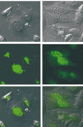 Figure 8. Fluorescence microscopic images of the cellular distribution of tc6 (left) and lna6 (right) in HeLa cells (top: phase contrast image; center: