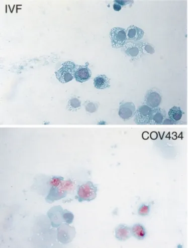 Figure 1. Light microscopic images of COV434 granulosa cells and of granulosa cells collected from an in-vitro fertilization (IVF) patient