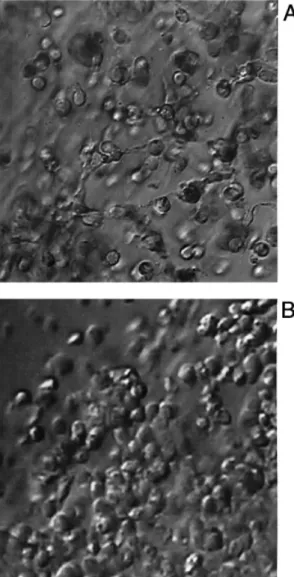 Figure 4. Scanning electron microscopic image of immortalized COV434 granulosa cells in the presence of an intact oocyte