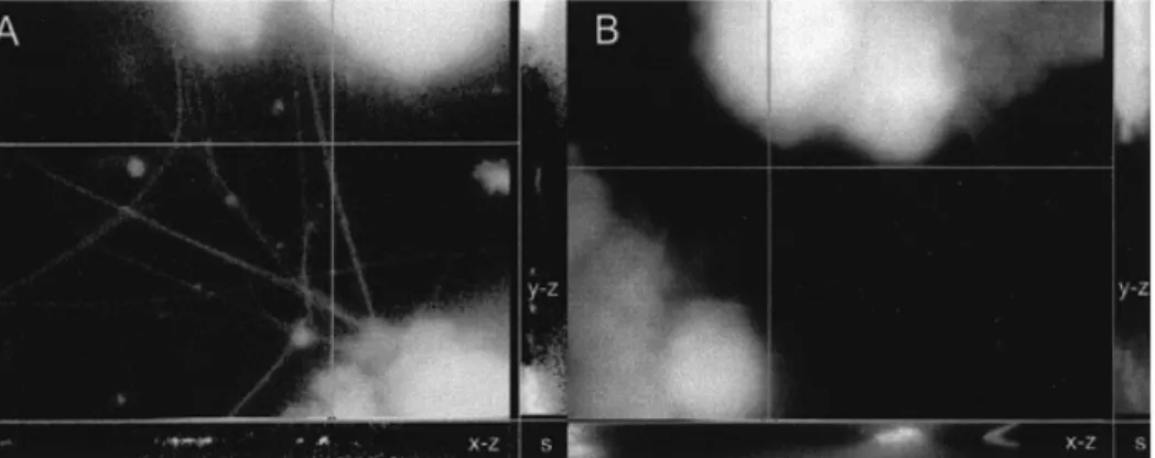 Figure 5. Confocal images of COV434 granulosa cells stimulated by an oocyte (A) and in the absence of an oocyte (B), projected in x–y (main image), x–z (bottom) and y–z (right) directions