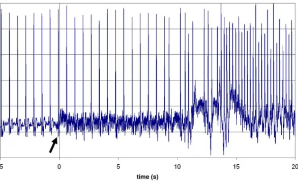 Figure 3 ECG recording of the MRI unit of Animal 1. The MRI scan starts at time-point zero (arrow), seen in the increased noise induced by the RF and gradient ﬁelds of the MRI unit
