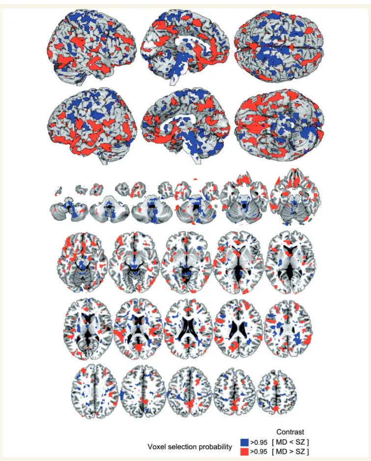 Figure 3 Voxel probability map (VPM) of reliable contributions to the major depression versus schizophrenia decision boundary