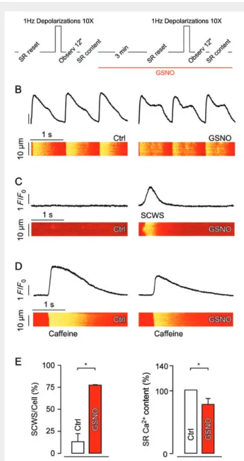 Figure 5 In beating cardiomyocytes, the NO donor GSNO increased diastolic Ca 2+ spark frequency and induced arrhythmogenic diastolic Ca 2+ waves