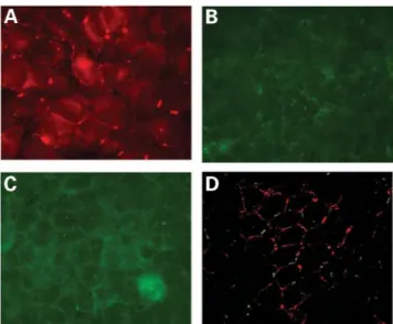 Figure 1. Expression of connexins in the stable cell lines. (A) RT–PCR ampli- ampli-fication of RNA from HeLa cells expressing WT-Cx31 (lane 1), WT-Cx31 and WT-Cx30.3 (lane 2), WT-Cx31 and F137L-Cx30.3 (lane 3), WT-Cx30.3 (lane 4), F137L-Cx30.3 (lane 5) an