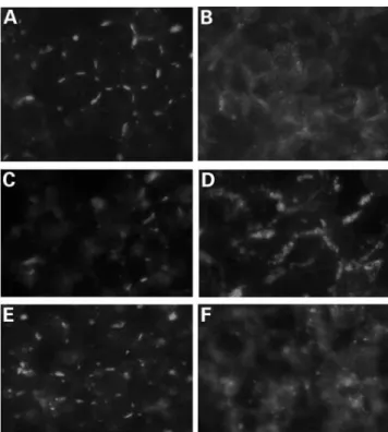 Figure 7. Influence of inhibitors of proteasome and lysosome on the degrada- degrada-tion of connexins in cells coexpressing WT-Cx31 with either WT-Cx30.3 (A, C and E) or F137L-Cx30.3 (B, D and F)