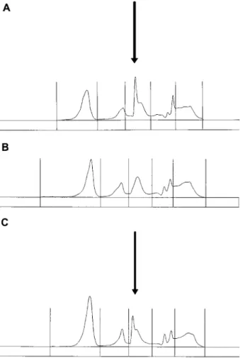 Figure 1 Effect of ampicillin-sulbactam on serum CZE.
