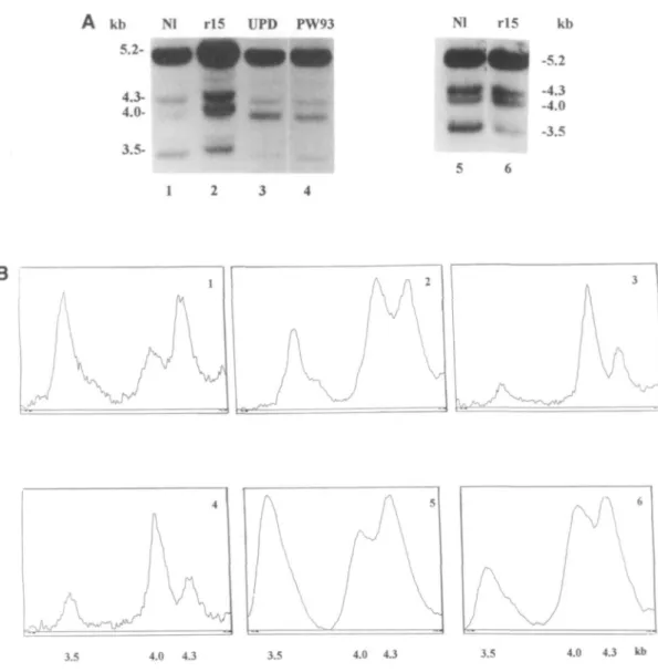 Figure 3. Methylation status at the D15S9 locus (ZNF127geat) of PWS patients. Methods are as described in figure 2