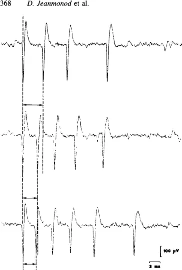 Fig. 3 Intrinsic organization of three bursts from the rhythmic bursting unit shown in Fig