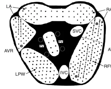 Fig. 1. Schematic of electrode arrays and bipolar electrode sites (dots).