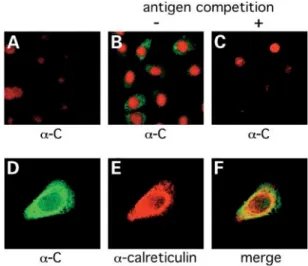 Figure 1. Immunolocalization of LEKTI in HK. HK were cultured in prolifer- prolifer-ating (low-calcium medium; A) or differentiating (high-calcium medium; B–F) conditions for 24 h, and processed for immunofluorescence microscopy  analy-sis as described in 