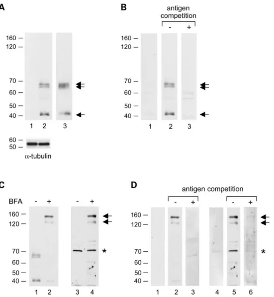 Figure 2. Molecular detection of LEKTI in HK. HK were cultured in proliferating (low-calcium medium) or differentiating (high-calcium medium) conditions for 24 h