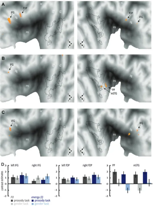 Figure 6. Functional activations for angry compared with neutral voices, taking into account the mean and the SD of the F0