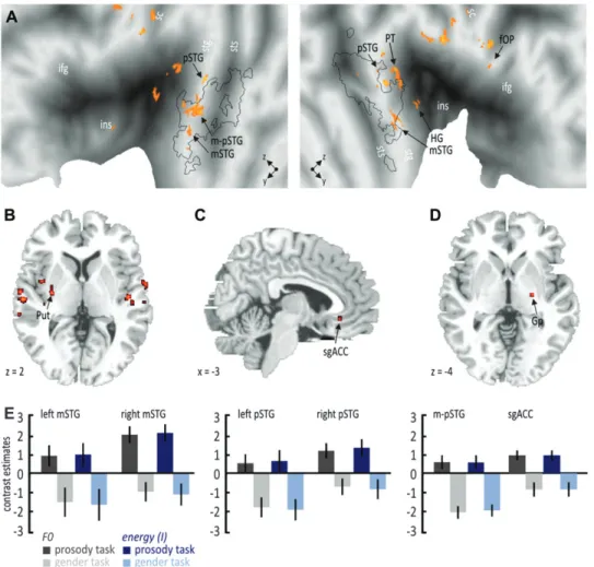 Figure 7. Specific activations as revealed by the interaction analysis for angry compared with neutral voices, taking into account the mean and the SD of the F0 and of the energy (I)