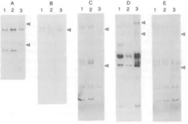 Figure 1. PCR-SSCP analysis in the FVII gene in five unrelated dysfunctional F VII variants