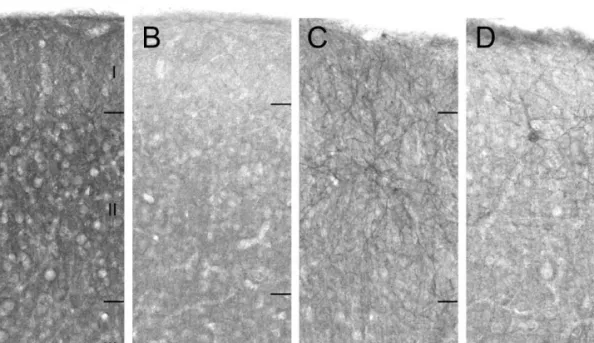 Fig. 7 Variability of a3-subunit immunoreactivity at the cellular level in the superficial neocortical layers in TLE specimens with