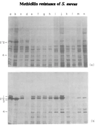 Figure 2. Membrane proteins and PBP's of the different methkillin-reastant mutants, (a) Coomassie blue stained gel of membrane proteins of the various strains, prepared as described in Materials and methods.