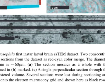 Fig. 5. Drosophila first instar larval brain ssTEM dataset. Two consecutive registered sections from the dataset as red-cyan color merge