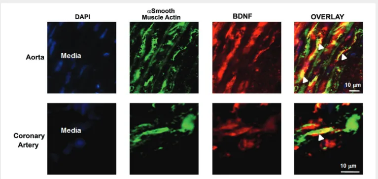 Figure 2 BDNF expression in vascular smooth muscle cells. Representative figures of the media of the aorta and the coronary artery collected from sedentary WKY show immunofluorescence staining for DAPI (blue), alpha smooth muscle actin (green), BDNF (red),