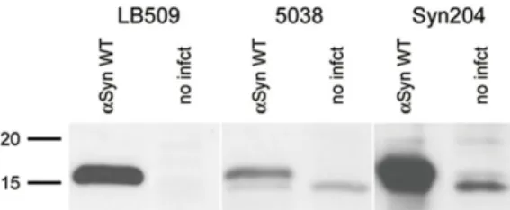 Figure 1. Alpha-synuclein expression in hNPC ctx . Western blot analysis of a-synuclein expression in hNPC ctx either uninfected or infected with a  lenti-virus for aSynWT over-expression