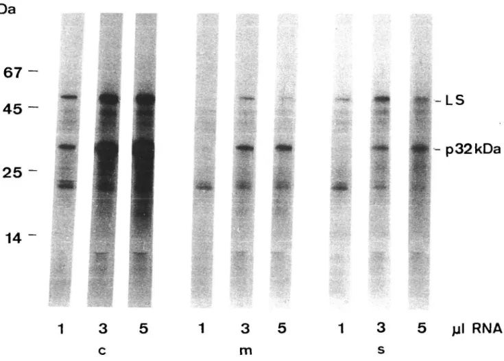Fig. 2 Fluorogram of the products of in vitro translation in reticulocyte lysate. RNAs were extracted from whole chloroplasts (c), membrane (m) and soluble (s) fractions