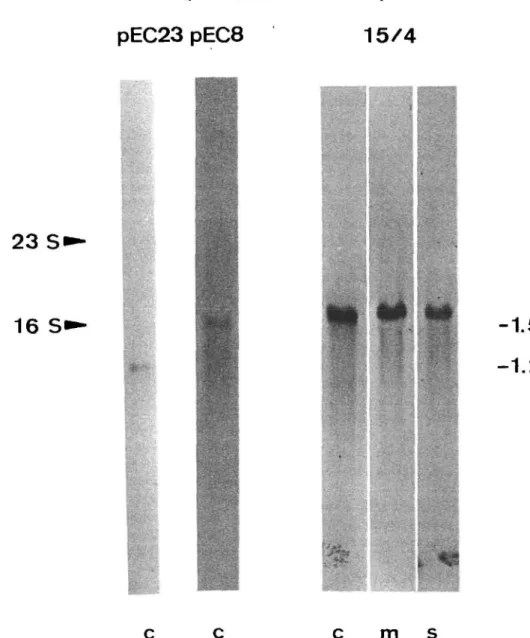 Fig. 3 Autoradiograms of Northern blot hybridizations with nicktranslated plasmids from pEC8 or 15/4 (LS-gene) and pEC23 (32 kDa gene)