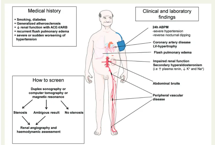 Table 4 Factors predicting effective revascularization of renal artery stenosis