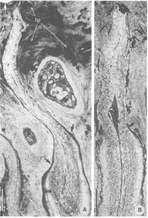 FIG. 7. Cladonia floerkeana, TEM micrographs of longitudinal sections of empty asci after ascospore release