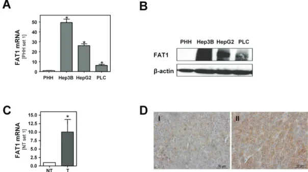 Fig. 1.  FAT1 expression in HCC. (A) mRNA and (B) protein expression of FAT1 in HCC cell lines (HepG2, PLC and Hep3B) and PHH