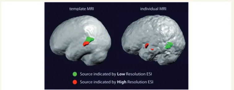 Figure 5 Sensitivity and specificity of the different imaging methods with respect to surgery outcome