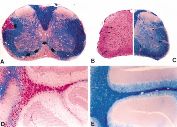 Fig. 2 Demyelination in MOG-induced EAE and TNF transgenic mice depends on the expression of TNFR1