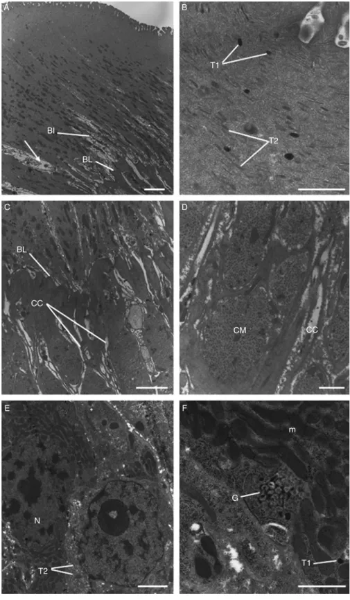 Fig. 4. A –F, Transmission electron micrographs of the tegument and sub-tegumental tissues of adult triclabendazole-resistant Fasciola hepatica, 72 h p.t