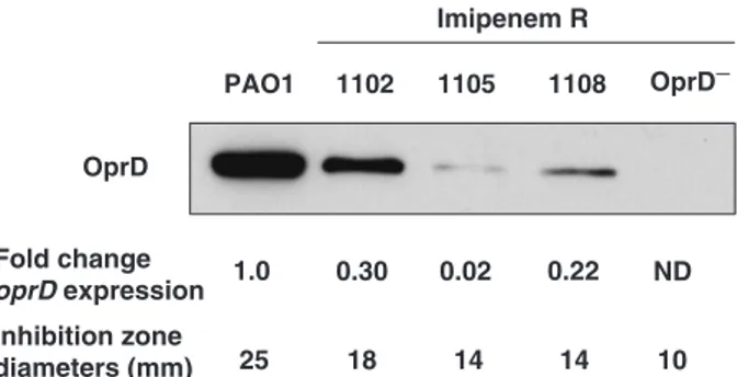 Fig. 1. Comparison between OprD expression in PT5 wild-type strain and in imipenem-resistant derivatives by western blot analysis and quantitative real-time PCR (qRT-PCR)