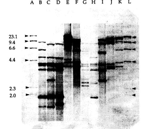 Fig.  1.  Ribotype  patterns  generated  from  P.  intermedia  and  P.  nigrescens  strains  after  treatment  of  chromosomal  DNA  with  PstI