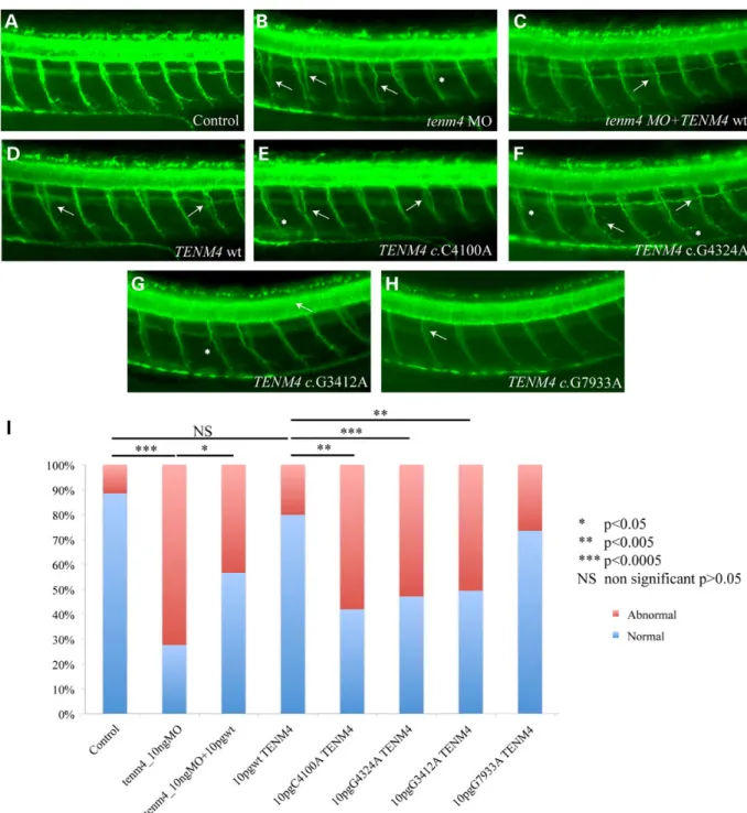 Figure 3. Suppression oftenm4 in zebra ﬁ sh causes defects in motor axon path ﬁ nding, outgrowth and branching