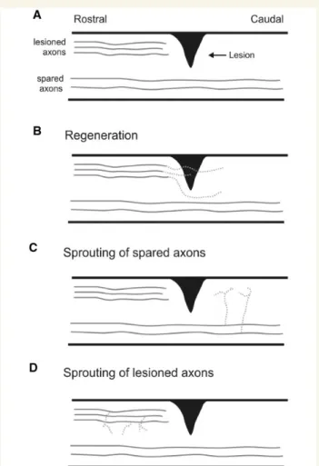 Figure 3 Axon regeneration versus sprouting after a spinal cord injury. The figure summarizes the mechanisms of regeneration and sprouting after a spinal tract damage