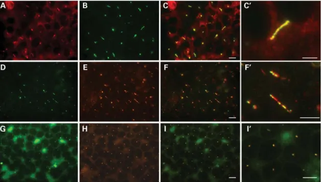 Figure 3. Immunofluorescence analysis of IMCD3 cell cultures for ciliary expression of UMOD