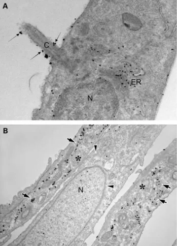 Figure 4. Analyzing UMOD expression in cilia by electron microscopy. (A) Endogenous ciliary UMOD expression in post-confluent IMCD3 cells was studied by electron microscopy