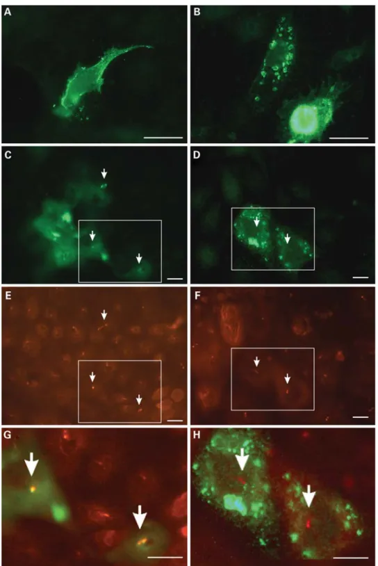 Figure 5. Overexpression of wild-type and mutant UMOD in IMCD3 cells. IMCD3 cells were transfected with wild-type (A,C,E,G) or C150S mutant UMOD – EGFP fusion constructs (B,D,F,H) and processed for immunofluorescence staining