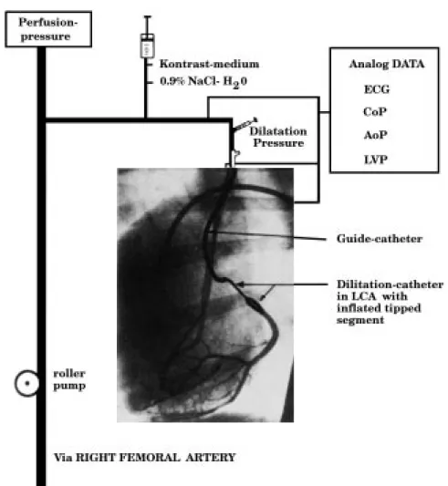 Figure 1 The first experimental set-up for balloon dilatation of coronary stenoses in the dog