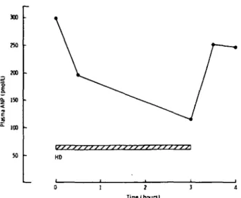 Fig. 3. Sequential plasma ANP concentrations in three patients before, during, and after 3 h haemodialysis treatment