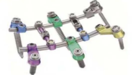 Figure 3.4 : système ST 360 de ZIMMER TM [2].