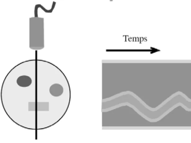 Figure 10 : Echographie en mode TM  Le mode Doppler : 